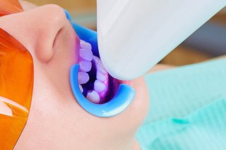 Madhubala Dental Clinic,best dental clinic in tirupattur,best dentist in tirupattur,best Root canal treatment in tirupattur,best Laser treatment in tirupattur,best invisalign treatment in tirupattur,dentist near me tirupattur,madhubala dental hospital tirupattur,madhubala dental clinic tirupattur.