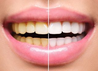 Madhubala Dental Clinic,best dental clinic in tirupattur,best dentist in tirupattur,best Root canal treatment in tirupattur,best Laser treatment in tirupattur,best invisalign treatment in tirupattur,dentist near me tirupattur,madhubala dental hospital tirupattur,madhubala dental clinic tirupattur.