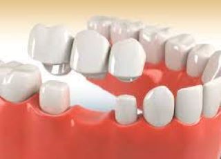 Madhubala Dental Clinic,best dental clinic in tirupattur,best dentist in tirupattur,best Root canal treatment in tirupattur,best Laser treatment in tirupattur,best invisalign treatment in tirupattur,dentist near me tirupattur,madhubala dental hospital tirupattur,madhubala dental clinic tirupattur.