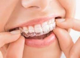 Madhubala Dental Clinic,best dental clinic in tirupattur,best dentist in tirupattur,best Root canal treatment in tirupattur,best Laser treatment in tirupattur,best invisalign treatment in tirupattur,dentist near me tirupattur,madhubala dental hospital tirupattur,madhubala dental clinic tirupattur.