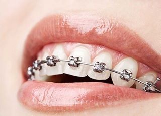 Madhubala Dental Clinic,best dental clinic in tirupattur,best dentist in tirupattur,best Root canal treatment in tirupattur,best Laser treatment in tirupattur,best invisalign treatment in tirupattur,dentist near me tirupattur,madhubala dental hospital tirupattur,madhubala dental clinic tirupattur.