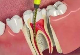 Madhubala Dental Clinic,best dental clinic in tirupattur,best dentist in tirupattur,best Root canal treatment in tirupattur,best Laser treatment in tirupattur,best invisalign treatment in tirupattur,dentist near me tirupattur,madhubala dental hospital tirupattur,madhubala dental clinic tirupattur.