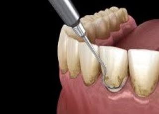 Madhubala Dental Clinic,best dental clinic in tirupattur,best dentist in tirupattur,best Root canal treatment in tirupattur,best Laser treatment in tirupattur,best invisalign treatment in tirupattur,dentist near me tirupattur,madhubala dental hospital tirupattur,madhubala dental clinic tirupattur.