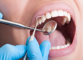 Madhubala Dental Clinic,best dental clinic in tirupattur,best dentist in tirupattur,best Root canal treatment in tirupattur,best Laser treatment in tirupattur,best invisalign treatment in tirupattur,dentist near me tirupattur,madhubala dental hospital tirupattur,madhubala dental clinic tirupattur.