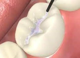 Madhubala Dental Clinic,best dental clinic in tirupattur,best dentist in tirupattur,best Root canal treatment in tirupattur,best Laser treatment in tirupattur,best invisalign treatment in tirupattur,dentist near me tirupattur,madhubala dental hospital tirupattur,madhubala dental clinic tirupattur.